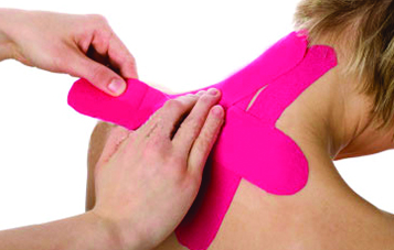 Taping NeuroMuscolare