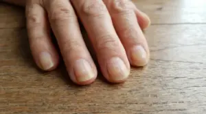 Primo piano di una mano appoggiata su un tavolo, con unghie leggermente ingiallite