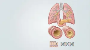 Illustrazione di polmoni e pancreas con muco nei bronchi e sezione di vie aeree, legata alla fibrosi cistica